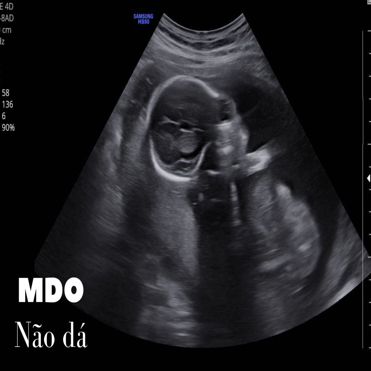 Não dá - Single by MDO (Menino de Ouro) album cover